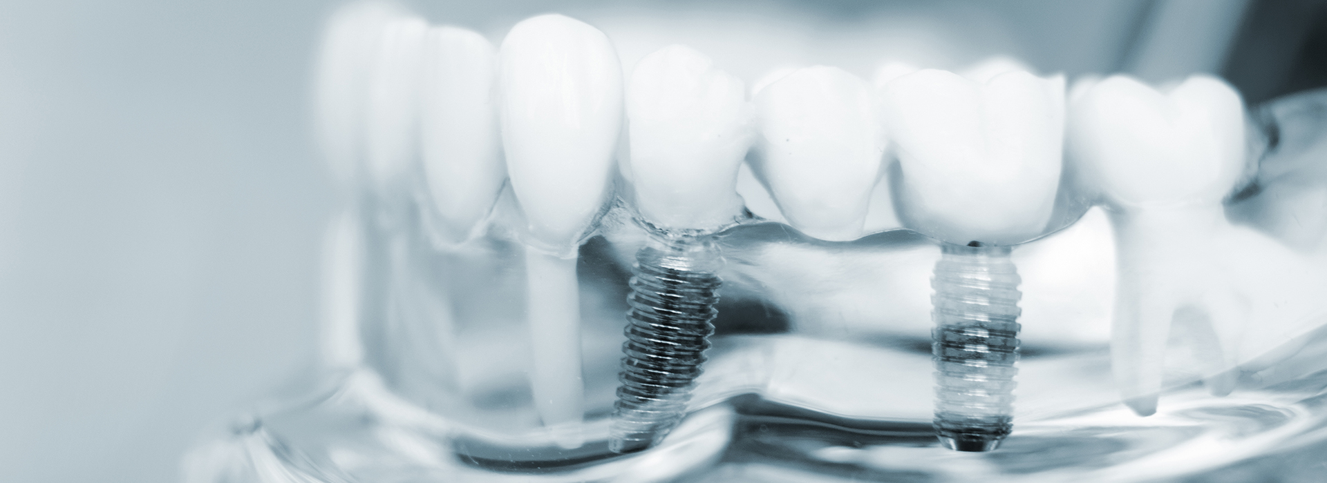 The image shows a close-up of multiple teeth with visible toothpaste and water droplets, suggesting an advertisement or demonstration related to oral hygiene.